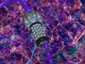 Charles Ostman - theoretical neural repair nano-biodevice