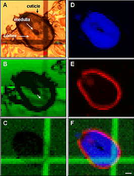 (A) Cross-section of human hair under visible light illumination. The cuticle, cortex, and medulla are indicated. (B) FTIRM reflectivity image of the Au grid. The white arrow indicates the grid intersection, used for the image correlation. (C) Au SXRF microprobe image of the Au grid. (D) FTIRM image of the protein content in the hair, generated by plotting the Amide I peak area from 1600 - 1700 cm-1. (E) XRF microprobe image of copper content in the hair. (F) A red-green-blue (RGB) color image illustrating the correlation of the protein from FTIRM (blue channel) and Cu content from XRF microprobe (red channel) in the tissue. The gold grid pattern from SXRF microprobe is placed in the green channel. Scale bar for all images is 20 µm. 