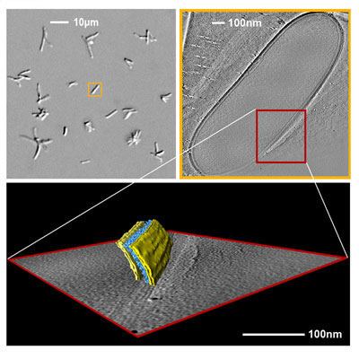 Light and electron tomographic images of Mycobacterium bovis BCG. Top left: Several mycobacteria in the light microscope with about 1000 times magnification. Top right: Longitudinal section through a three-dimensionally reconstructed bacterial cell of 1.5 m in length. The data were recorded in an electron microscope using the technique of cryo-electron tomography. The white bar indicates 100 nanometer or 0.1 micron. Bottom: 3-D structure of a section through the mycobacterial cell envelope. The structural details are color-coded. In yellow: the inner (left) and the outer (right) lipid bilayer. In blue: cell wall polymers that bind the mycolic acids. The cell envelope is 35 nanometers thick.

Image: Christian Hoffmann/Harald Engelhardt, MPI of Biochemistry, Martinsried, Germany