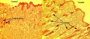 Luna Innovations Incorporated discovers their nanomedicine prototype aids in the growth of new hair follicles. These photographs, taken through a microscope at 10X magnification, are of thin slices of skin revealing mouse hair follicles. The figure to the left is from a hairless mouse treated with a placebo (the control). The figure to the right is treated with Luna's prototype and shows there is a four fold increase in follicle buds and the buds are more developed after two weeks of treatment. (Photo: Business Wire)