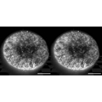 Figure 1: A stereo pair of images demonstrating the three-dimensional reconstruction of the distribution of nuclear pore complexes within the nuclear membrane from a serial set of HILO images. Scale bars = 5.0 μm.