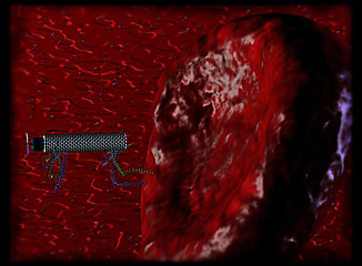 From the video Bend It Like NIST, artist rendition of a tiny robot approaching a malfunctioning red blood cell in order to destroy it. NIST-organized soccer competitions for microbots provide a venue for testing agility, maneuverability, response to computer control and the ability to move objectsall skills that future miniaturized surgeons will need.

Still Credit: Constantinos Mavroidis, BionanoRobotics Laboratory, Northeastern University