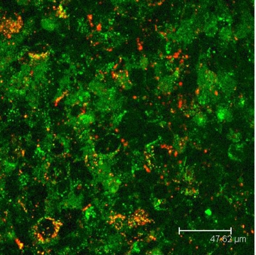 This confocal microscope image of a blood-brain barrier model shows quantum rods bioconjugated with transferrin; the findings could lead to better treatment of neuronal disorders. 