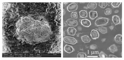 bacillus anthracis spores as viewed in SEM (left) and TEM (right). (Photo courtesy of Sandia National Laboratories)