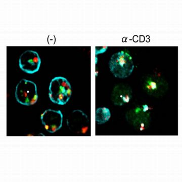 Figure 1: Interaction between TCR, CD3 and LAPTM5. Left, CD3ζ (blue) is localized on the plasma membrane whereas LAPTM5 (green) and the lysosome-associated protein LAMP1 (red) are in the lysosomes in T cells before stimulation. Right, after TCR stimulation (α-CD3), CD3ζ moves to the lysosomal compartment where it co-localizes with LAPTM5 and LAMP1 and is degraded.
Reproduced, with permission, from Ref. 1  2008 Elsevier Inc.
