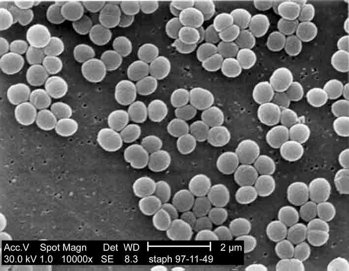 SEM image of staphylococcus aureus