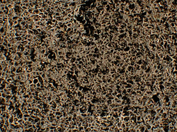 This microscope image of the remains of upholstery foam with carbon nanofiber additives after a burn test shows that the nanofibers in the foam retained their initial arrangement during the combustion process, forming an insulating structure with an extremely low density. Researchers believe that this carbon foam acts as a sponge to absorb the molten foam during burning and to prevent dripping. (Image shows a sample 24 millimeters across.)

Credit: NIST