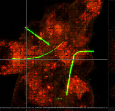 This image depicts several cells coated with fluorescent dyes making them appear red. Three nanowires  the neon green lines  have successfully attached themselves to the cells. When a low frequency electromagnetic field is applied, the nanowires heat up and destroy the attached cells. 