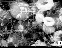 'Electron microscope view of platinum nanowires with beads.'

Credit - University of Rochester
