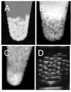 Microcapsules with embedded gadolium-gold nanoparticles can be easily visualized with A (T1-weighted positive contrast MR imaging), B (T2-weighted negative contrast MR imaging). C (X-ray/CT imaging) or D (ultrasound imaging). (Credit: Dian Arifin/Bulte Lab)