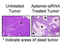 A mouse tumor treated with an aptamer-siRNA combination (right) shows many dead areas (indicated by the asterisks), whereas an untreated tumor (left) is still largely intact. Delivering siRNA successfully to specific cells has been challenging. UI researchers modified siRNA so that it could be injected into the bloodstream and impact only targeted cells.