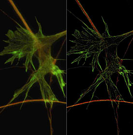 Photograph of neuronal growth cone with widefield microscopy (left) and SR-SIM, staining for tubulin (red) and F-actin (green). Specimen:
M. Fritz and M. Bastmeyer, University of Karlsruhe (TH), Germany.
