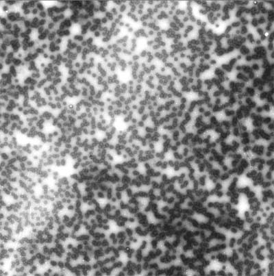 Electron Micrograph of PEG-POD DNA complexes indicates that each nanoparticle is approximately 136 nm in size. Credit: courtesy of Tufts University School of Medicine.