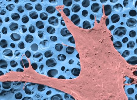 Image of a cell growing on an artificial scaffold, developed at Swansea University, which could be used for wound healing 