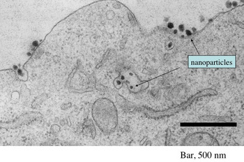 This electron micrograph shows the presence of numerous siRNA-containing targeted nanoparticles both entering and within a tumor cell. Credit: Caltech/Swaroop Mishra