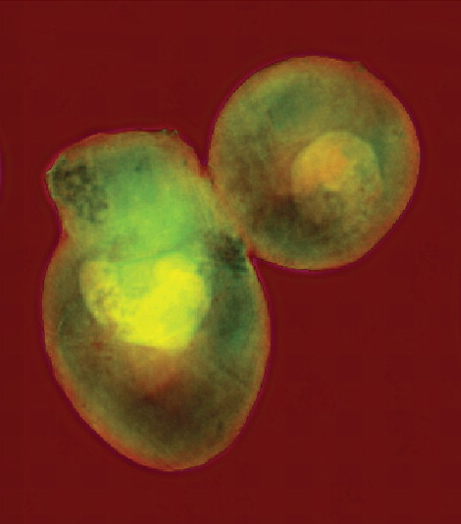 A pair of yeast cells imaged at very high resolution using coherent soft x-rays at the Advanced Light Sources beamline 9.0.1. The coherent (laser-like) beam of penetrating x-rays allows a computer to reconstruct the cells internal structures from a diffraction pattern, without focusing the light with a lens.