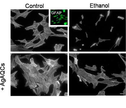 The top left image shows the actin cytoskeleton of the control astrocytes; on the right, cells exposed to ethanol, showing alterations to both the cell morphology and the actin cytoskeleton. The bottom images show the effects of applying silver nanoparticles; on the right, the ethanol causes no alteration of the actin cytoskeleton
