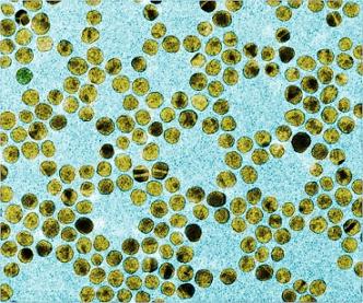 An image of gold nanoparticles. Image courtesy Kimberly Hamad-Schifferli 