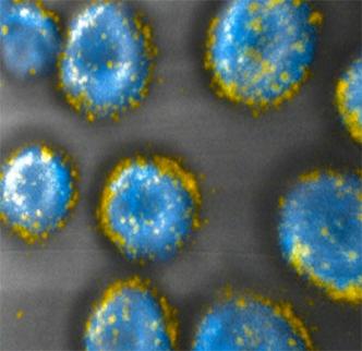 MIT engineers have developed a way to attach drug-carrying pouches (yellow) to the surfaces of cells.  Image: Darrell Irvine and Matthias Stephan