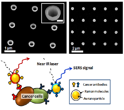 Fig.1: (above) SEM images of nanoparticles fabricated for SERS by electron-beam
lithography. (below) Illustration of multiplex cancer targeting by SERS nanoparticles encoded by Raman molecules and cancer antibodies.