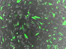 Brain cancer cells produce a green fluorescent protein. DNA encoded to produce the protein was delivered to the cancer cells by new freeze-dried nanoparticles produced by Johns Hopkins biomedical engineers.
Stephany Tzeng 