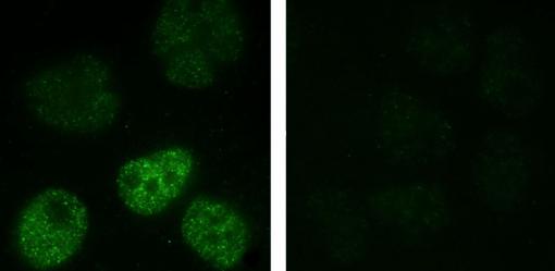 Now you see it, now you dont 
When human lung epithelial cells are exposed to equivalent doses of nano-sized (left) or micro-sized (right) metallic nickel particles, activated HIF-1 alpha pathways (stained green) appear mostly with the nanoparticles. 