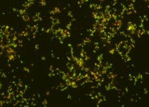 Nanoparticles, in green, targeting bacteria, shown in red.
Image: Aleks Radovic-Moreno
