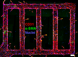 Provided/Stroock lab
Reconstruction of fluorescence confocal micrographs of a microvascular network with endothelial-cell lined channels (red) and perivascular cells (green) in collagen. After two weeks in culture, the presence of the tissue cells drove sprouting of new vessels from the original endothelium.