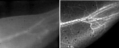 These images of a mouses blood vessels show the difference in resolution between traditional near-infrared fluorescence imaging (left) and Stanfords new NIR-II technique (right).