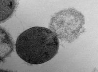 This is a transmission electron microscopy image of a Streptococcus pyogenes cell experiencing lysis after exposure to the highly active enzyme PlyC.

Credit: Daniel Nelson, UMD