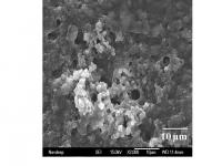 Researchers at Rensselaer Polytechnic Institute have developed a new method to kill deadly pathogenic bacteria in food handling and packaging. Using nature as their inspiration, the researchers successfully attached cell lytic enzymes to food-safe silica nanoparticles, and created a coating (seen up close in this scanning electron micrograph image) with the demonstrated ability to selectively kill listeria -- a dangerous foodborne bacteria that causes an estimated 500 deaths every year in the United States.

Credit: Rensselaer/Dordick