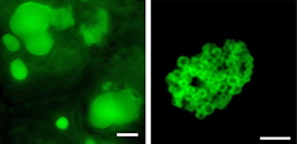 Increasing oil accumulation in leaves: Overexpressing the gene for PDAT, an enzyme involved in oil production, caused plant leaves to accumulate large amounts of oil in large globules (left). When the scientists also added a gene for olesin, a protein known to encapsulate oil droplets (fused to green fluorescent protein to confirm its location), clusters of smaller, more stable oil droplets formed (right).