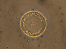 A submerged micropost causes the surrounding liquid crystal to form a ring pattern, directing nanoparticles on the surface.