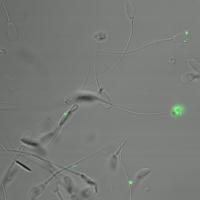 This is boar sperm mixed with mesoporous silica nanoparticles that have been tagged with fluorescent green dye for identification. These nanoparticles were developed by Oxford University researchers to investigate 'mystery' cases of infertility. They can be loaded with any compound to identify, diagnose or treat the causes of infertility.

Credit: Natalia Barkalina/Oxford University