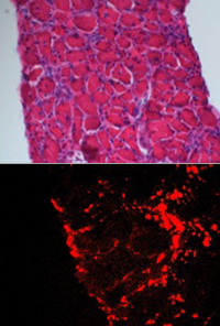 FASEB Journal
Shown is a diaphragm muscle of a mouse with muscular dystrophy (top). Pictured below are fluorescent nanoparticles (red) lodged in the diaphragm. 