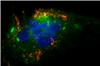 Immunofluorescence image shows nanoparticles targeted to endothelial cells. The red particles turn orange when overlapping with the green caveolin in the lipid rafts of the cells. Source: Julia Voigt / Prasad Shastri