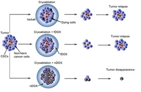 A schematic illustration of the resistance of cancer stem-like cells (CSCs) to cryoablation alone and its combination with free doxorubicin (fDOX) and nanoparticle-encapsulated doxorubicin (nDOX). Cryoablation may destroy most tumor cells while the remnant CSCs will reinitiate tumor growth and tumor relapse ensues. The combination of cryoablation and fDOX is not effective enough to destroy all CSCs either to prevent tumor relapse. In contrast, cryoablation combined with nDOX can effectively kill all CSCs, resulting in the eventual elimination of cancer because the non-stem cancer cells could not create the heterogeneity (e.g., cancer cells, fibroblasts, and endothelial cells) in tumor to sustain its growth.