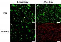 This figure from the paper shows the X-ray destruction of human breast cancer cells using Cu-Cy particles. The images show the live cancer cells stained green and the dead cells stained red.

Credit: Wei Chen/UT Arlington