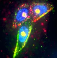 Prostate cancer cells were targeted by two separate silver nanoparticles (red and green), while the cell nucleus was labeled in blueusing Hoescht dye.

Credit: UCSB