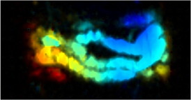 Applying a method that uses nanoparticles to create visual contrast, a researcher created the above photoacoustic image of a mouse intestine. The colors indicate the depth of the intestine (red: deep; blue: shallow).

Photo: Jonathan Lovell