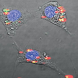Image: Prabhas Moghe, et. al.
Rare-earth nanoparticles encapsulated in albumin shells glow under infrared light.