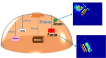 Using a silicone model of a breast and embedding objects representing lumps, scientists have successfully tested an electronic skin that can accurately "feel" and image lumps much smaller than those detectable by manual exams.
Credit:American Chemical Society