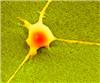 Scanning electron micrograph showing a neuron on a nanorough surface making intimate contact with the surface. Surfaces has been given a false color for visualization. Source: Nils Blumenthal and Prasad Shastri