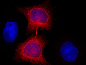 On target: When researchers introduced nanobodies they made to cells engineered to express a target protein in skeletal fibers known as tubulin (red), the nanobodies latched on. The cells above have recently divided.