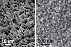 These scanning electron microscopy images, taken at different magnifications, show the structure of new hydrogels made of nanoparticles interacting with long polymer chains.

Courtesy of the researchers