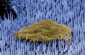 The image shows a single human cell (brown) on a bed of nanoneedles (blue). This image was taken by the researchers using electron microscopy.
CREDIT: Imperial College London
