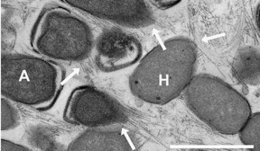 Electron micrograph of the nanowires shows connecting archaea and sulphate reducing bacteria. The wires stretch out for several micrometres, longer than a single cell. The white bar represents the length of one micrometre. The arrows indicate the nanowires (A=ANME-Archaeen, H=HotSeep-1 partner bacteria).
CREDIT: MPI f. Biophysical Chemistry