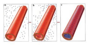 a) This image shows loading clay nanotubes with drug from saturation solution. b,c) Mixing with drug solution, pumping out air, and pulling in drug molecules, washing, and loaded tubes.
CREDIT: the author's of the article