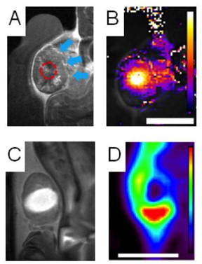 Clockwise from top left: A tumor (blue arrows) is heated with ultrasound (red dashed line); heat map of tumor during treatment; PET scan shows nanoparticles in surviving tumor margin; bright contrast agent shows area damaged by heat.
CREDIT: Andrew Wong/UC Davis