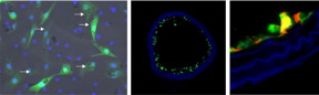 On the left are fluorescence-labeled cells with nanoparticles: The cellular nuclei are shown in blue, the fluorescence labeling is shown in green and the nanoparticles in the cells are identified by arrows. The middle photo shows a blood vessel populated with these cells (green). On the right is a detailed image of a vascular wall with the eNOS protein identified (red).

Photo: Dr. Sarah Rieck/Dr. Sarah Vosen/University of Bonn